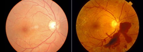 ��� ���� ���� �̹���