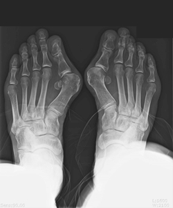 ��� ���� ���� �̹���