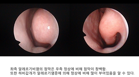 ��� ���� ���� �̹���