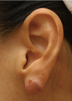 ��� ���� ���� �̹���