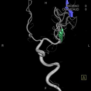 ��� ���� ���� �̹���