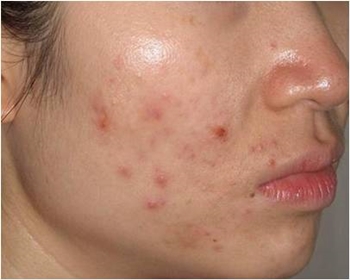 ��� ���� ���� �̹���