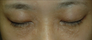 ��� ���� ���� �̹���