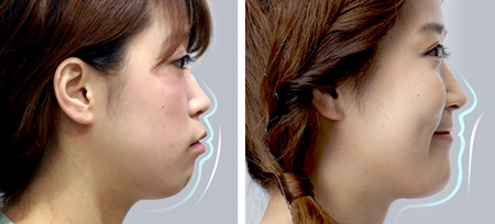 ��� ���� ���� �̹���