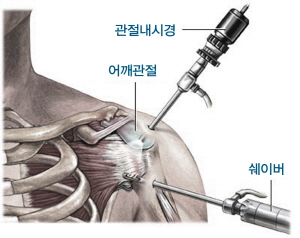 ��� ���� ���� �̹���