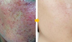 ��� ���� ���� �̹���