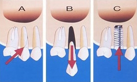 ��� ���� ���� �̹���