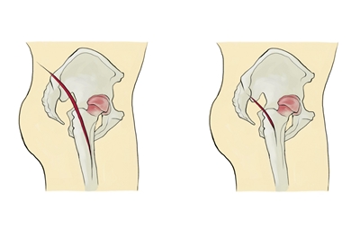 ��� ���� ���� �̹���