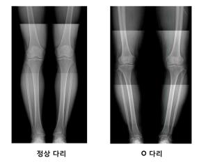 ��� ���� ���� �̹���