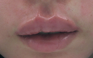 ��� ���� ���� �̹���