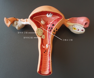 ��� ���� ���� �̹���