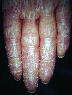 ��� ���� ���� �̹���