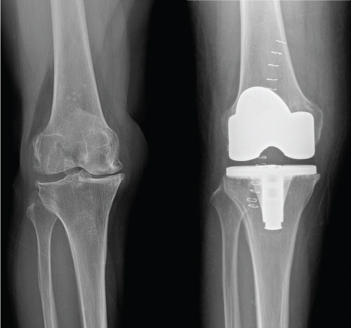 ��� ���� ���� �̹���