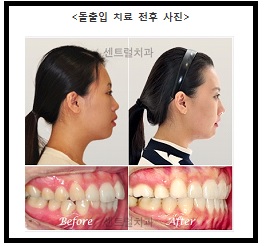 ��� ���� ���� �̹���