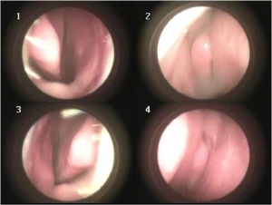 ��� ���� ���� �̹���