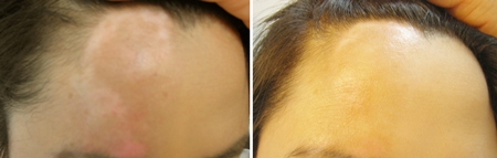 ��� ���� ���� �̹���