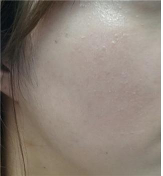 ��� ���� ���� �̹���