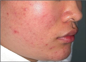 ��� ���� ���� �̹���