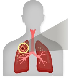 ��� ���� ���� �̹���