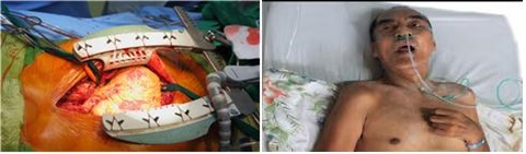 ��� ���� ���� �̹���