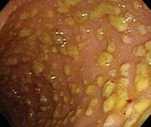 ��� ���� ���� �̹���