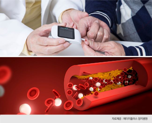 ��� ���� ���� �̹���