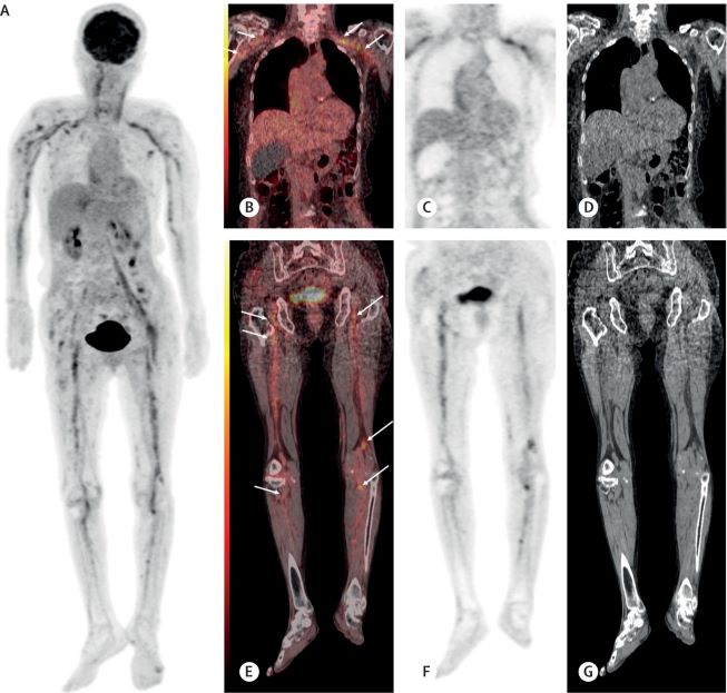 ��� ���� ���� �̹���